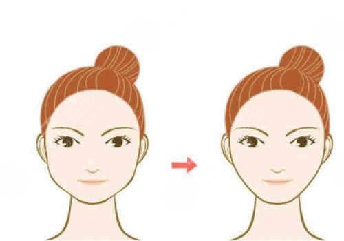 做完輪廓手術(shù)臉更大了怎么回事？