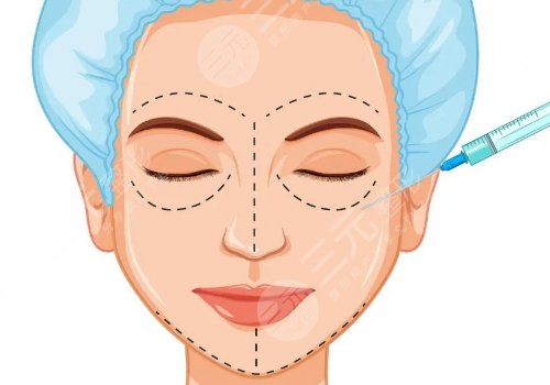 做完輪廓手術(shù)臉更大了怎么回事？