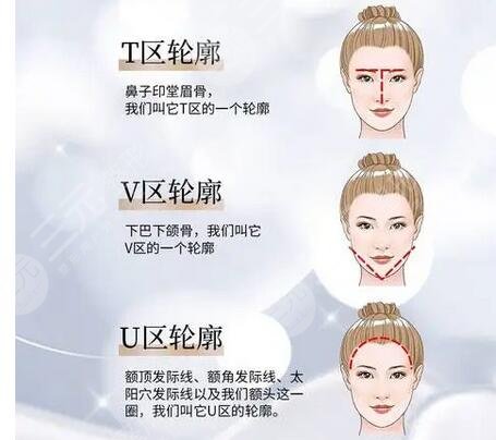 內(nèi)輪廓和外輪廓的位置區(qū)別