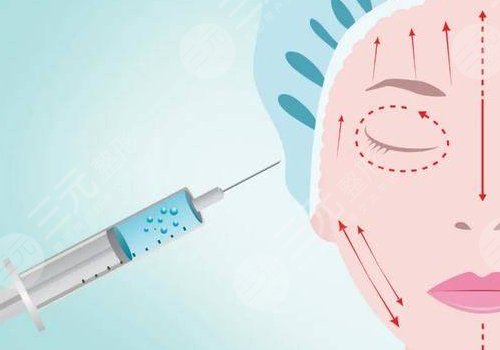 打了輪廓針多久可以懷孕