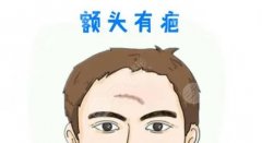 整形去除臉部縫針疤痕的方法科普！祛疤修復(fù)價格表分享！