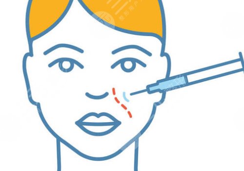 瑞藍玻尿酸打在哪個部位？
