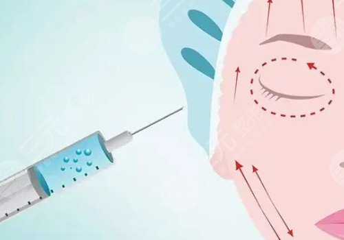 瑞藍玻尿酸打在哪個部位？