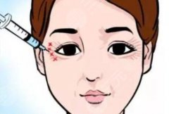 上眼皮松弛有褶皺怎么辦？2種醫(yī)美手術(shù)改良，重塑緊致眼周！