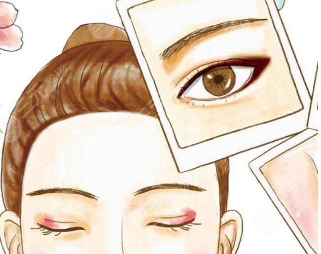 上瞼矯正結(jié)合雙眼皮