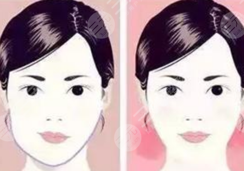 臉型歪了不對(duì)稱(chēng)怎么整