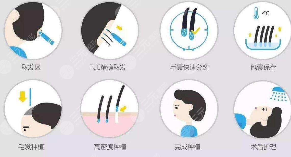 上海九院整形科植發(fā)費用