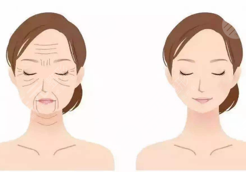 上海九院拉皮手術(shù)費(fèi)用多少?