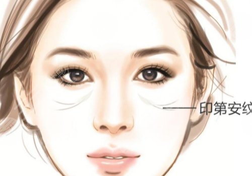 印第安紋怎么去除？