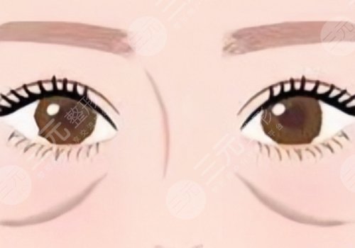 印第安紋怎么去除？