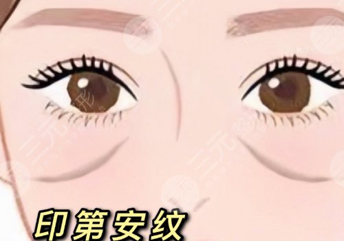 印第安紋和淚溝的區(qū)別是什么？