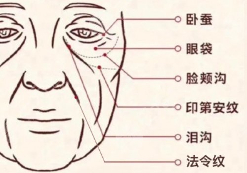印第安紋和淚溝的區(qū)別是什么？
