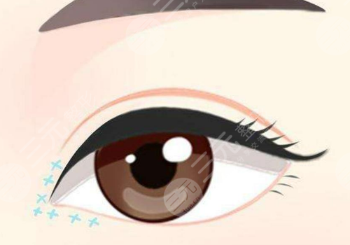 青海潤美整形美容醫(yī)院是正規(guī)的嗎