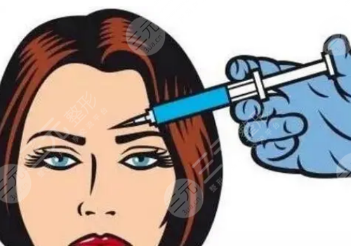 額頭填充玻尿酸能保持多久