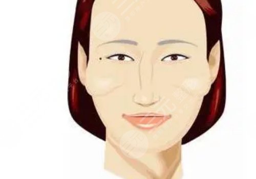 顴骨高怎么改良臉型？