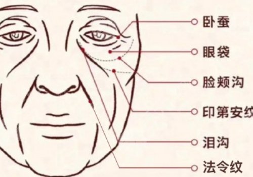 印第安紋填充膠原蛋白和玻尿酸哪個好？