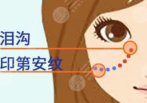 印第安紋填充膠原蛋白和玻尿酸哪個好？