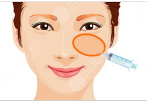 顴骨高有什么辦法改良？