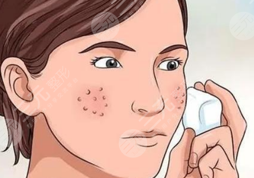 面頰毛孔粗大怎么辦？