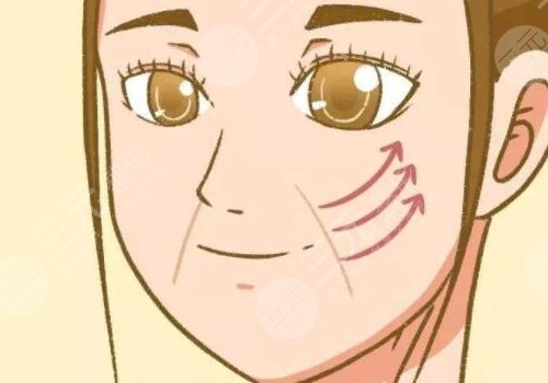 黃寅守拉皮手術(shù)怎么樣？