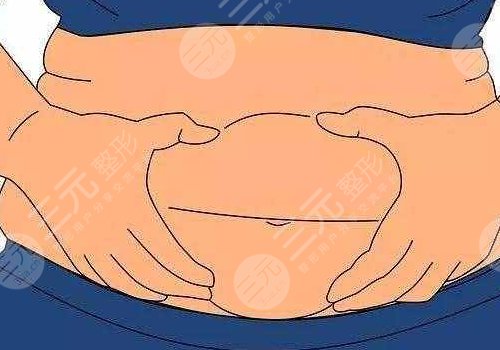 腹部拉皮手術(shù)風(fēng)險(xiǎn)大嗎