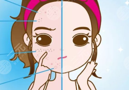 t區(qū)反復(fù)長(zhǎng)痘痘的原因是什么？