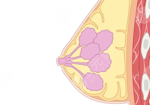 哪種胸型更好看？