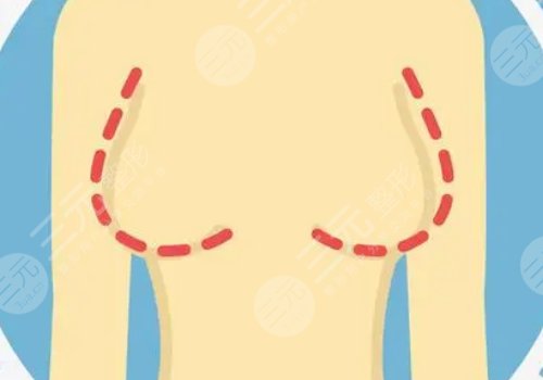哪種胸型更好看？