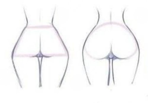 假體豐臀需要多少錢？