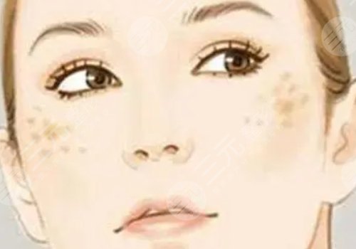 臉頰兩側(cè)長斑是什么原因？