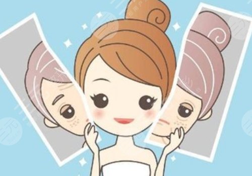 臉頰兩側(cè)長斑是什么原因？