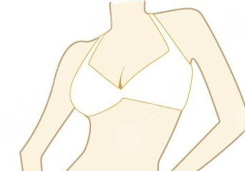 胸型不好看可以調(diào)整嗎？