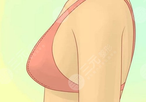 胸型不好看可以調(diào)整嗎？