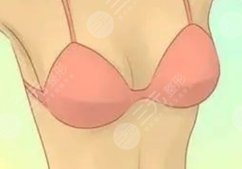 胸型不好看可以調(diào)整嗎？