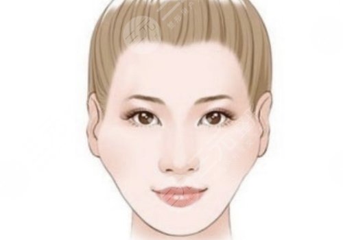 顴弓吸脂有什么后遺癥？