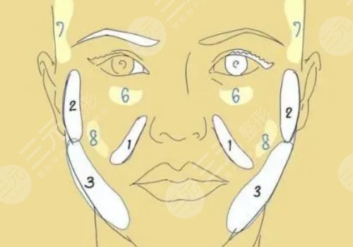 顴弓吸脂有什么后遺癥？