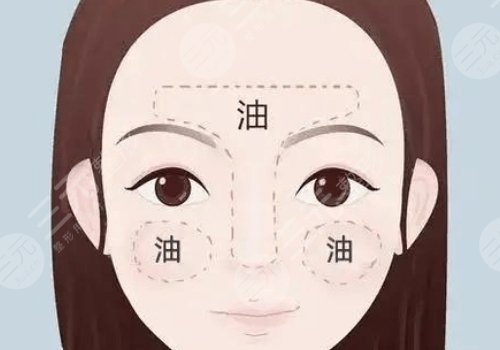 t區(qū)出油毛孔粗大怎么辦？