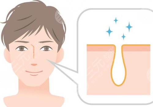 t區(qū)出油毛孔粗大怎么辦？