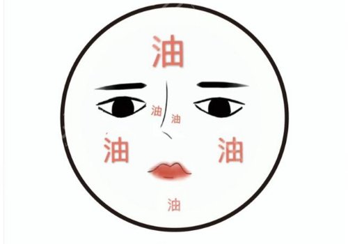 t區(qū)出油毛孔粗大怎么辦？