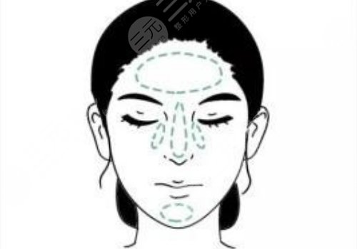 t區(qū)出油毛孔粗大怎么辦？