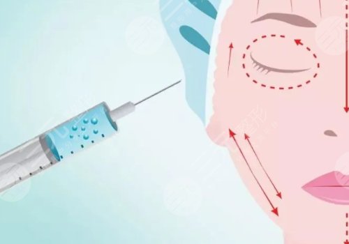 外輪廓固定提升有哪些手術(shù)方案？