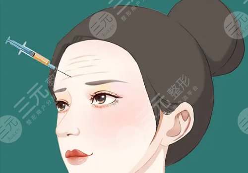 外輪廓提升需要幾支玻尿酸？