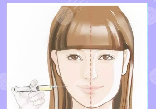 外輪廓提升需要幾支玻尿酸？