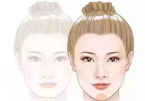 外輪廓提升需要幾支玻尿酸？