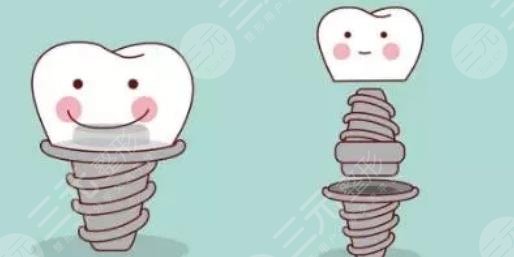 上海長海醫(yī)院牙科擅長項目科普