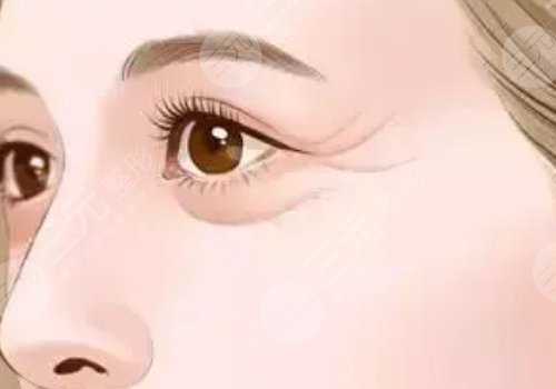 薇旖美可以注射眼部周圍的皺紋不？