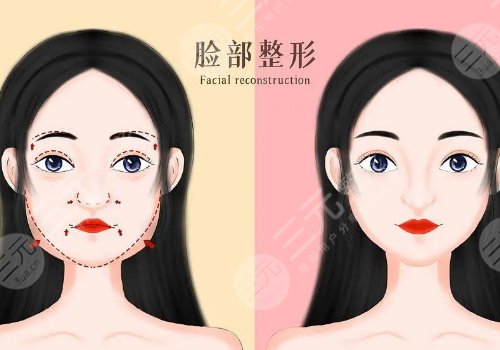 全臉幼態(tài)臉打造大概需要多少費(fèi)用？