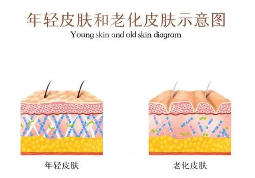 瑞藍(lán)唯瑅打完結(jié)塊怎么處理