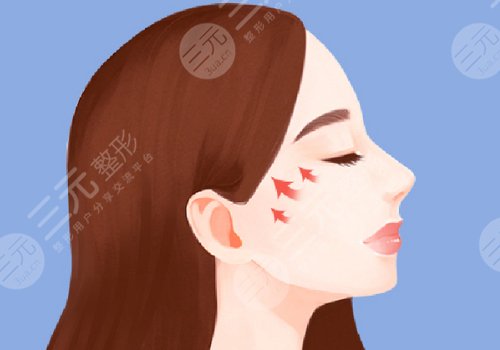 輪廓固定提升多少錢？