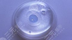 艾斯美乳房假體隆胸后怎樣？今天就來(lái)了解一下！